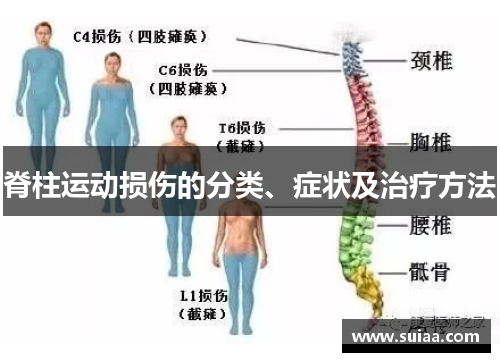 脊柱运动损伤的分类、症状及治疗方法